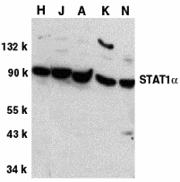 benchmark-antibodies_anti-stat1alpha_antibody_4141_1.jpg