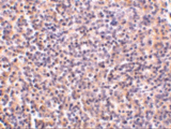 IHC rabbit anti tccr ct polyclonal antibody 9259