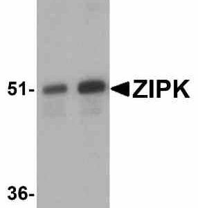 Western blot rabbit anti zip kinase polyclonal antibody 2387