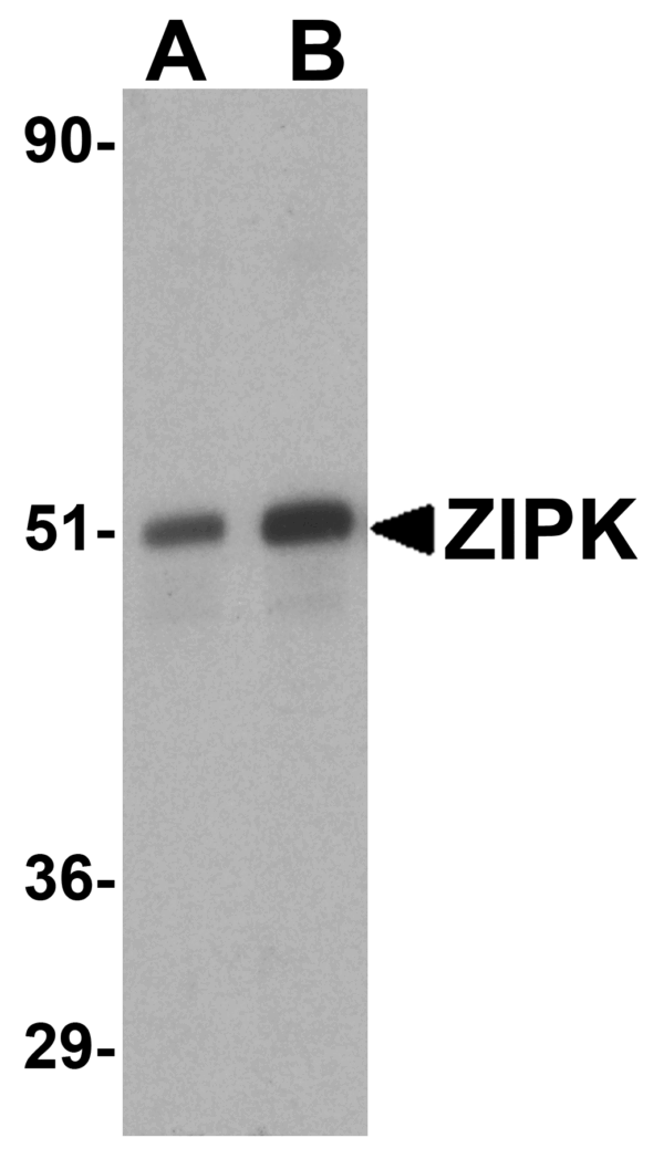 Western blot rabbit anti zip kinase polyclonal antibody 2387