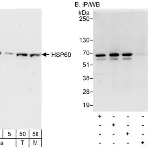 rabbit anti-Hsp60 polyclonal antibody 9023XXX