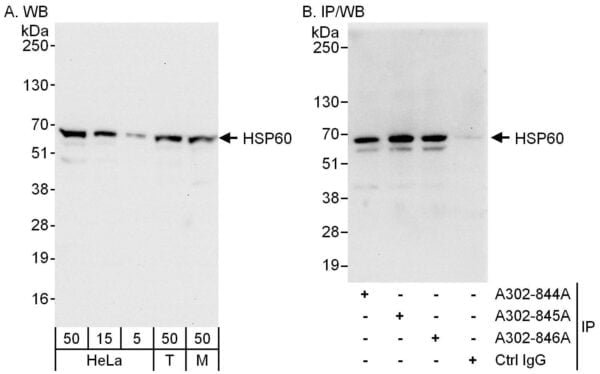 rabbit anti-Hsp60 polyclonal antibody 9023XXX