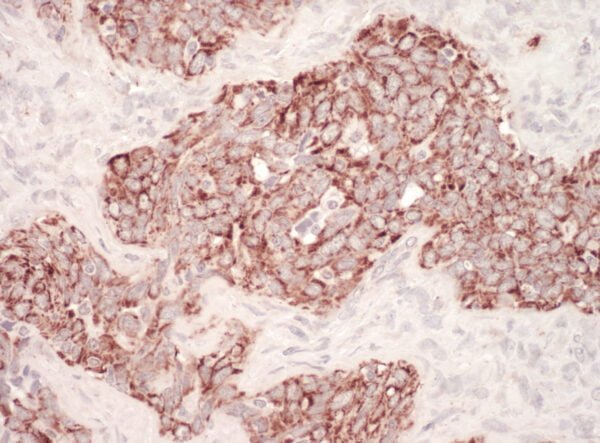 rabbit anti-Hsp60 polyclonal antibody 9023