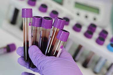 sample preparation
