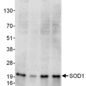 WB SOD1