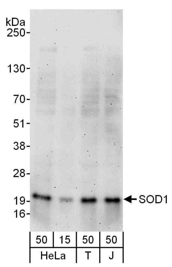 WB SOD1