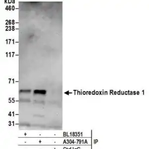 IP WB TRX1