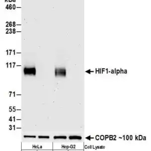 WB Hif1alpha
