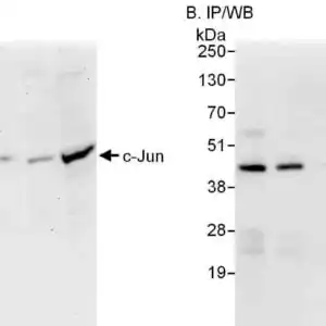 JNK WB