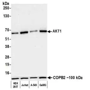 AKT1 WB
