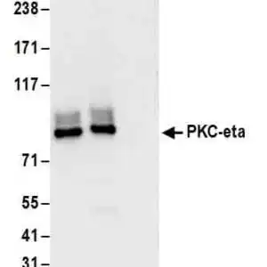 rabbit anti-KPc polyclonal antibody 1022