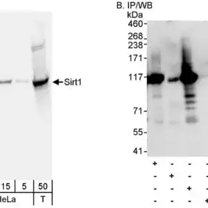 WB Sirt1