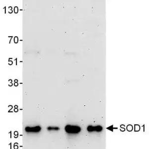 SOD1 WB