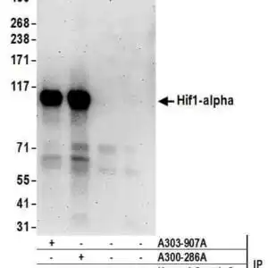 goat anti-HIF1a polyclonal antibody 1029