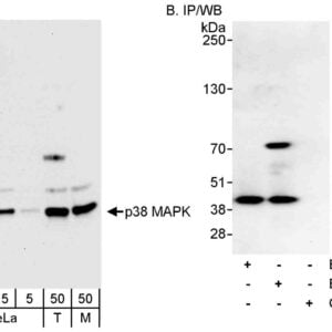 WB p38 MAPK