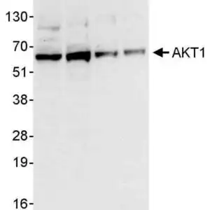 WB AKT1