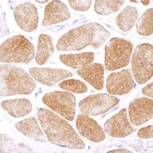 IHC