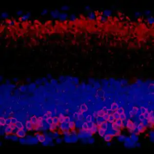 IHC FP