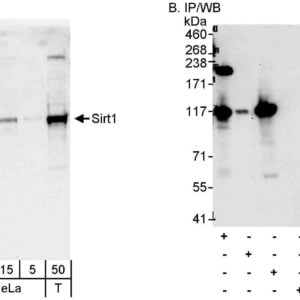 WB SIRT1