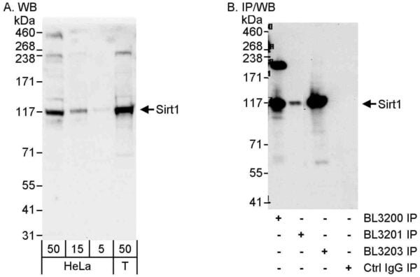 WB SIRT1