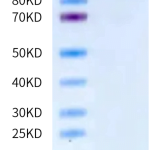 SDS-PAGE gel of Human VCAM-1/CD106 Protein 2003