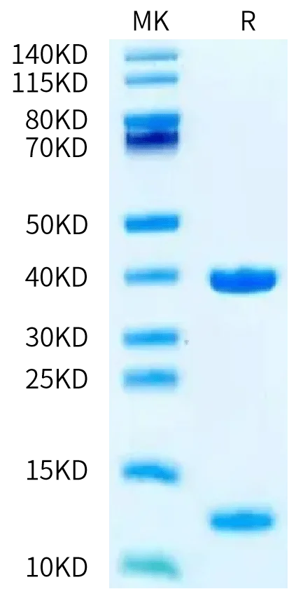 SDS-PAGE gel of Biotinylated Human HLA-A*02:01&B2M&P53 WT (HMTEVVRRC) M 2090