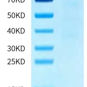 SDS-PAGE gel of Human CDH10/Cadherin-10 Protein 2124