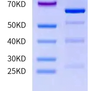 SDS-PAGE gel of Human TRIB3 Protein 2174