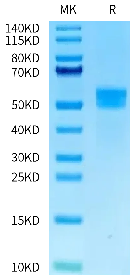 SDS-PAGE gel of Human MSLN/Mesothelin Protein 2240