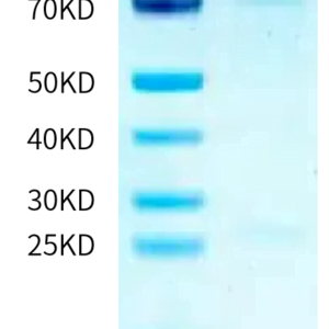 SDS-PAGE gel of Human PKC iota Protein 2252