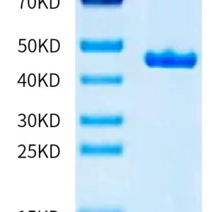 SDS-PAGE gel of Human CKMT1A Protein 2285