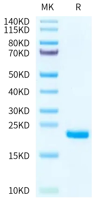 SDS-PAGE gel of Human IL-1F10/IL-38?Protein 2295