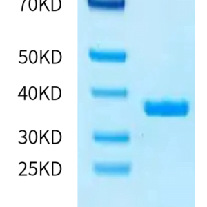 SDS-PAGE gel of Human ficolin 1/FCN1 Protein 2322