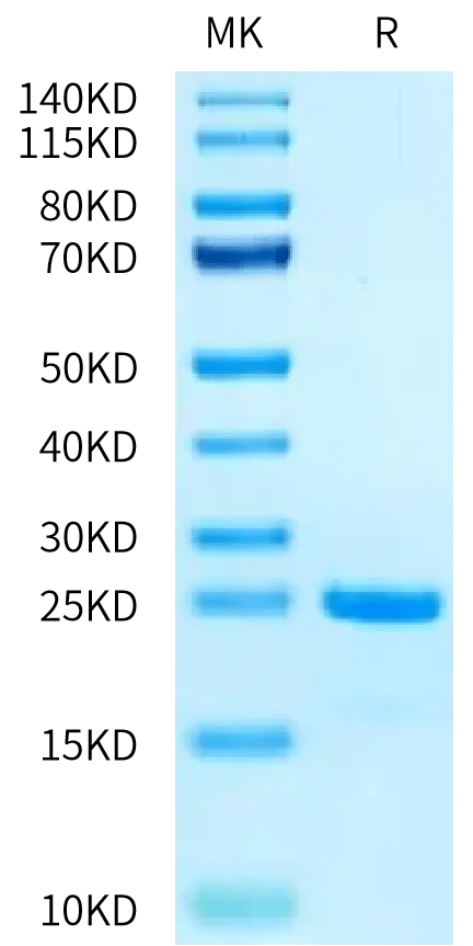 SDS-PAGE gel of Biotinylated Human SKP1 Protein 2328