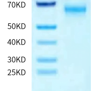 SDS-PAGE gel of Human SMOC1 Protein 2341