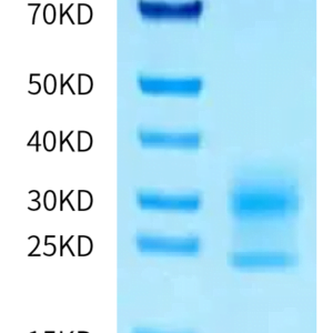 SDS-PAGE gel of Human NPC2 Protein 2353