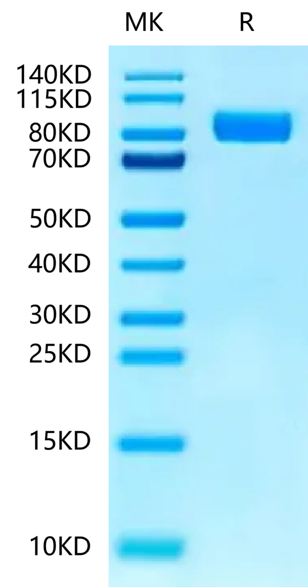 SDS-PAGE gel of Human IL-1RL1/ST2 Protein 2365