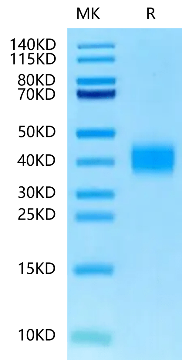 SDS-PAGE gel of Mouse TFPI-2 Protein 2367