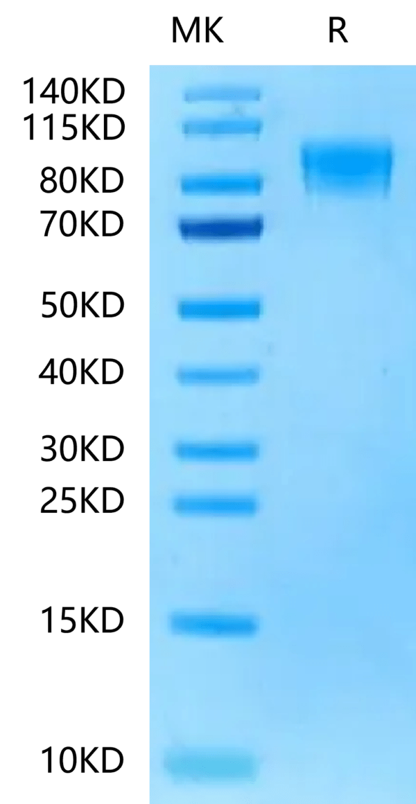 SDS-PAGE gel of Rat PDGF R beta/CD140b Protein 2370