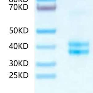 SDS-PAGE gel of Human tPA Protein 2378