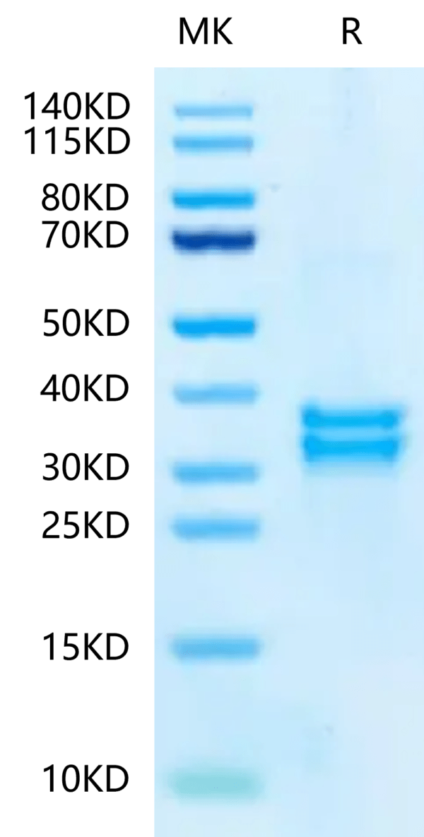 SDS-PAGE gel of Mouse tPA?Protein 2381