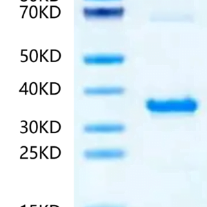 SDS-PAGE gel of Human NMNAT1?Protein 2383