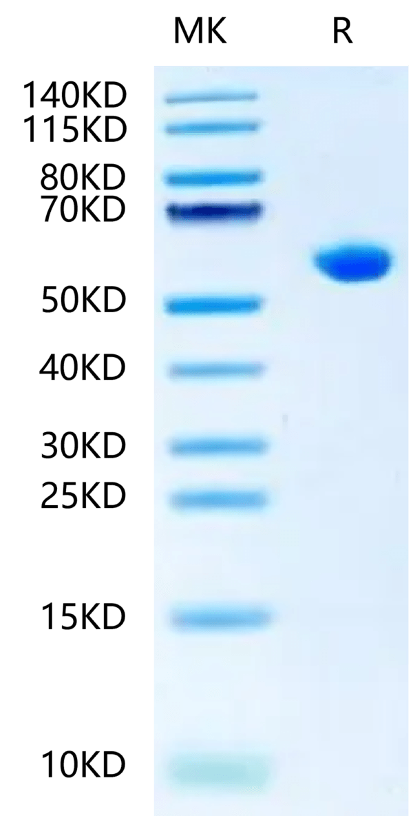 SDS-PAGE gel of Biotinlylated Human HLA-B*15:01&B2M&SARS-CoV-2 epitope  2399