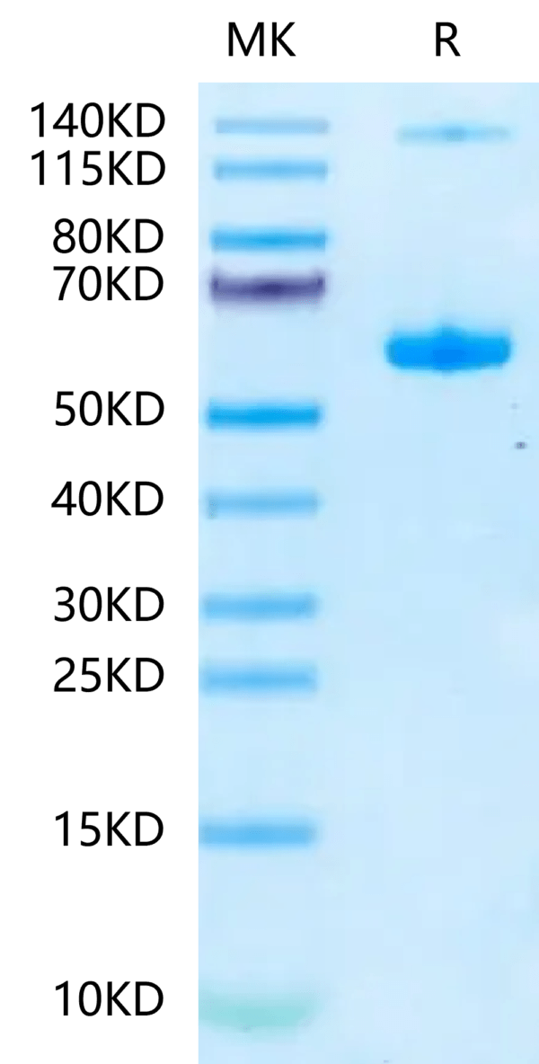 SDS-PAGE gel of Mouse Noggin Protein 2401