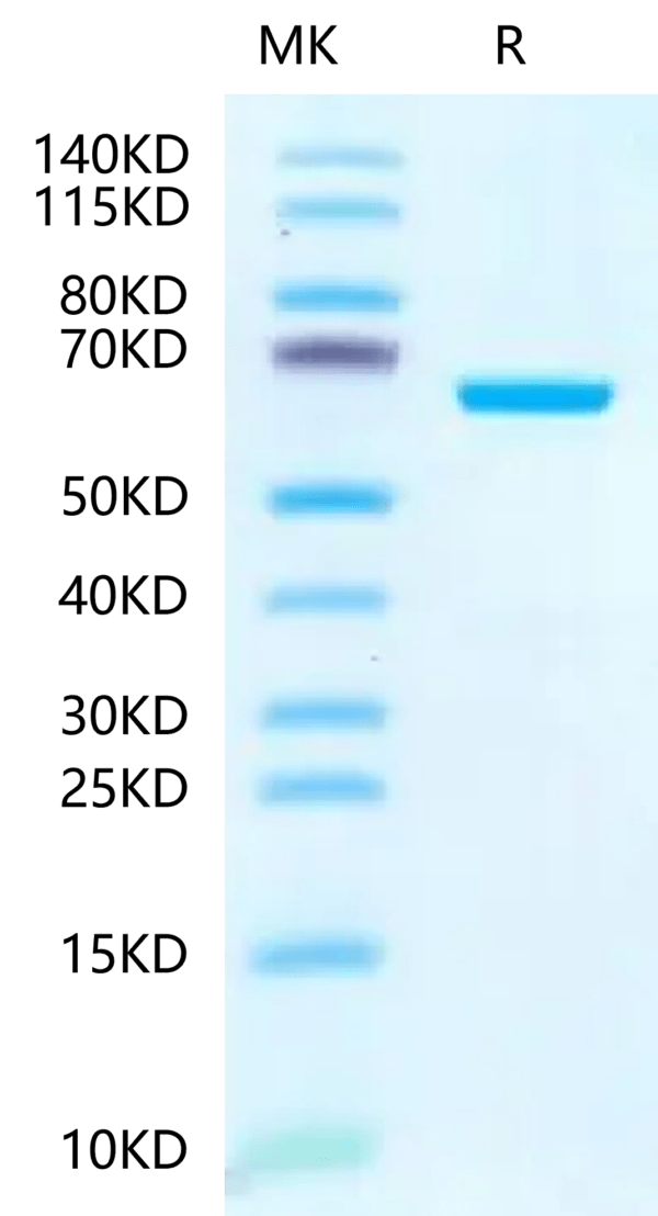 SDS-PAGE gel of Human IGFBP-7 Protein 2403