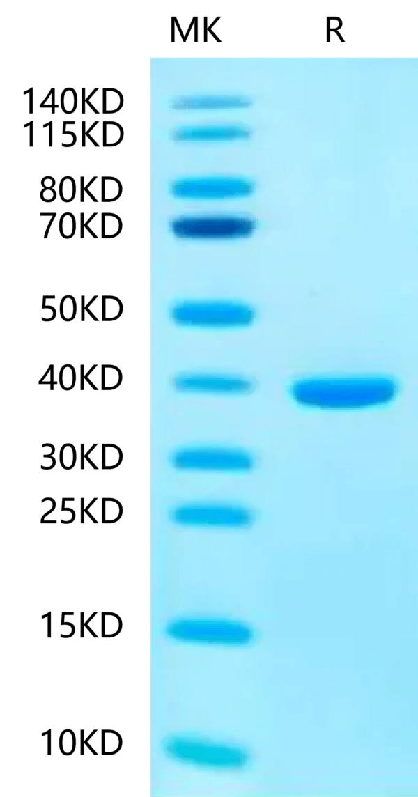 SDS-PAGE gel of Human SMR3B?Protein 2404