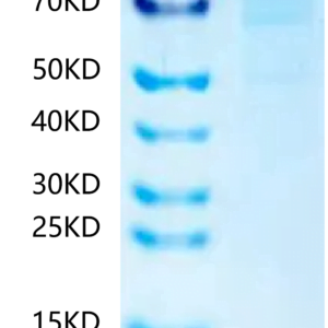 SDS-PAGE gel of Human N Cadherin?Protein 2411