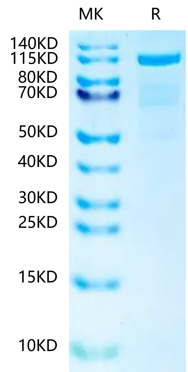 SDS-PAGE gel of Human N Cadherin?Protein 2411