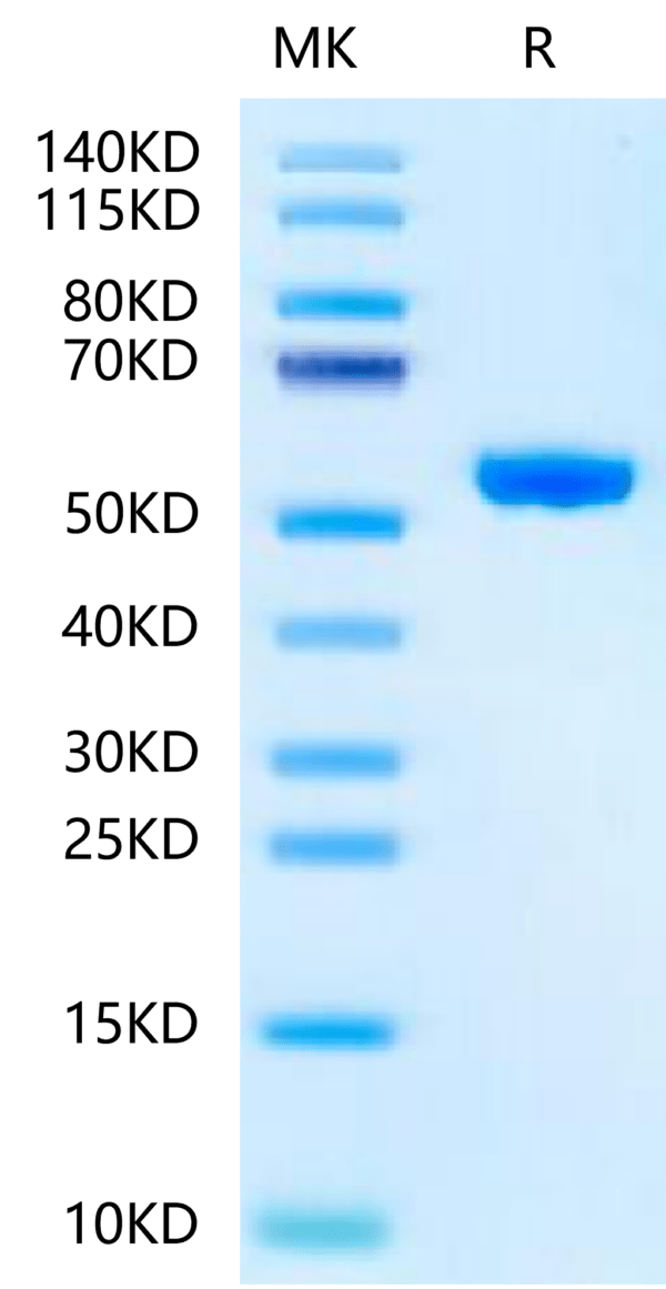 SDS-PAGE gel of Human Peptide Ready HLA-A*02:01&B2M Monomer?Protein 2413