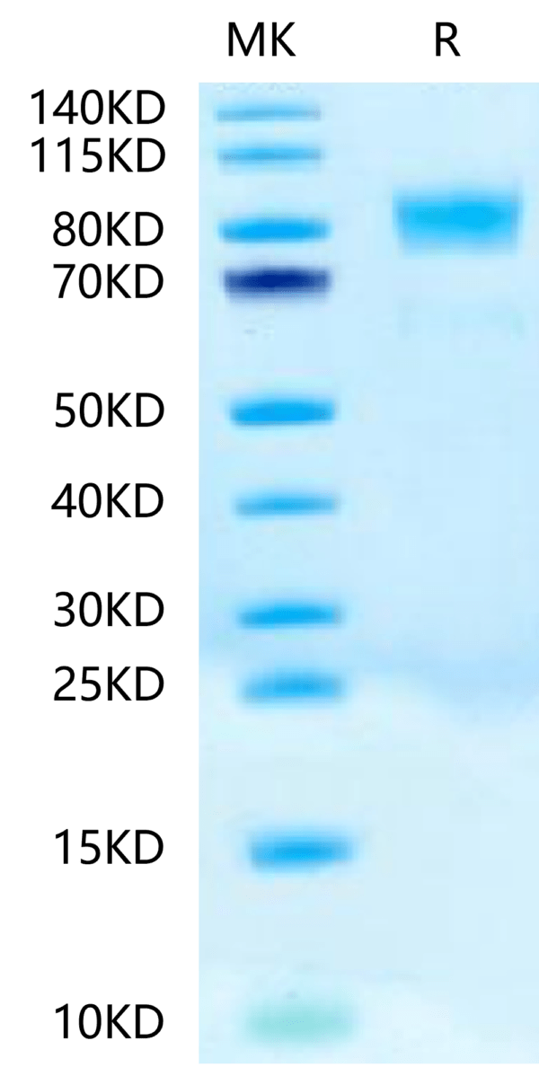 SDS-PAGE gel of Biotinylated Human CD117 Protein 2419